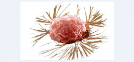 علائم و راه های تشخیص سرطان سینه