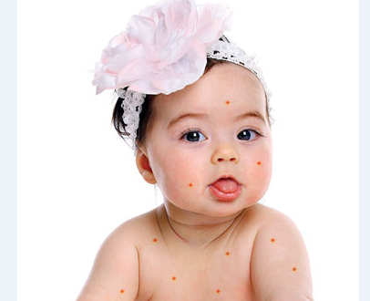 اختلالات پوستی در کودکان